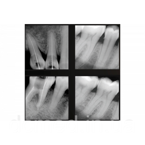 4177127566_viziograf-dentix-xvs2121