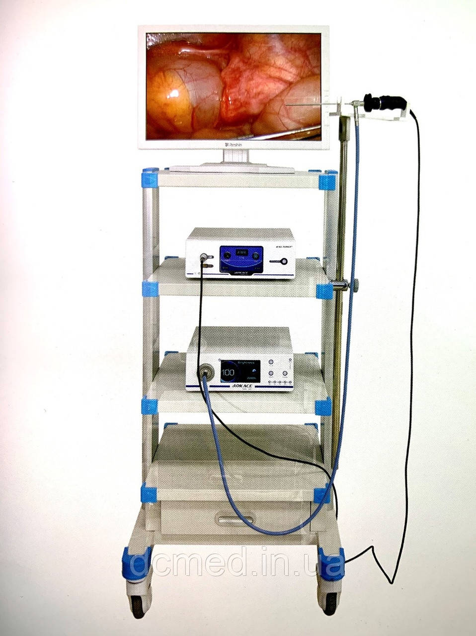 4470269736_laparoskopichna-stijka-loran