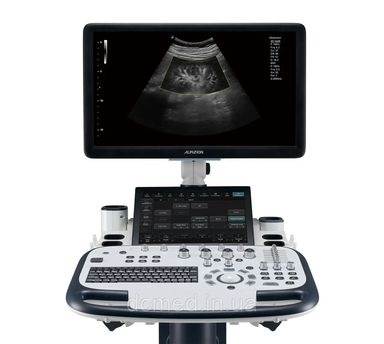 4600682689_ultrazvukova-diagnostichna-sistema