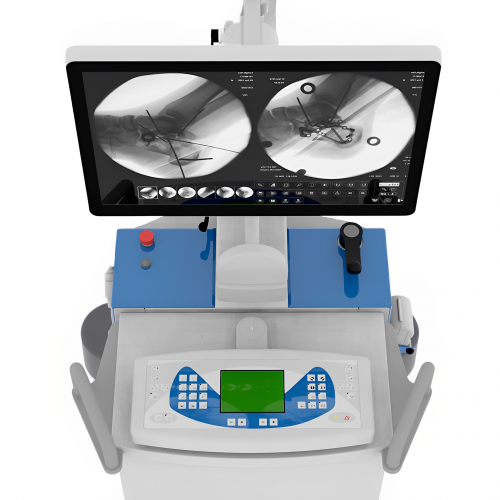 ТСА6ТСА6ТСА6